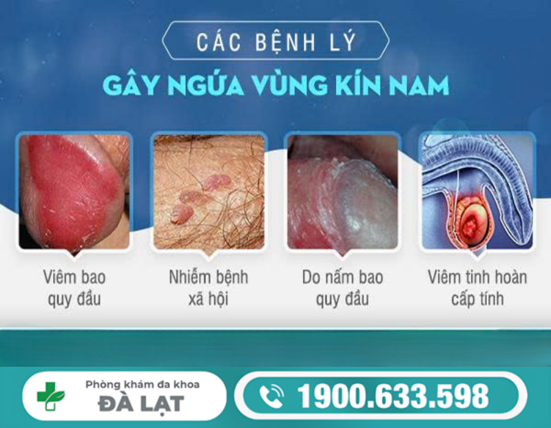 Hình ảnh minh họa